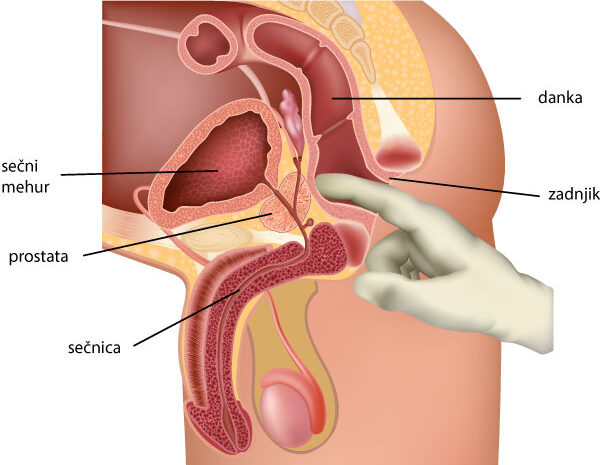 prostati-prostata