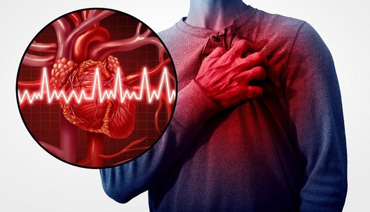 Human,Heart,Attack,Pain,As,An,Anatomy,Medical,Disease,Concept